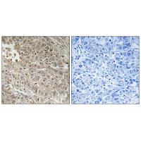 ABCC13 Antibody