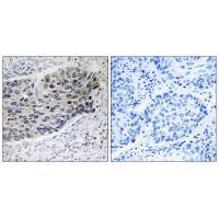 PC Antibody