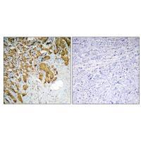 PDHA1 Antibody 