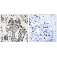 RAB3GAP2 Antibody