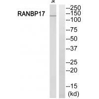 RANBP17 Antibody