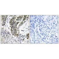 RREB1 Antibody