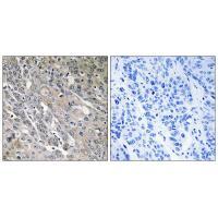 ARHGEF9 Antibody