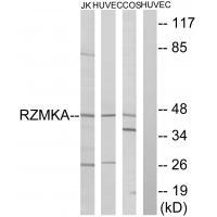 RIMKA Antibody 