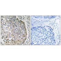 MRRF Antibody