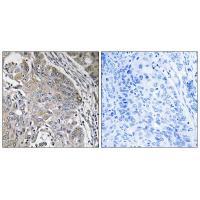 SPINK6 Antibody