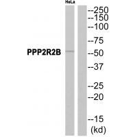 PPP2R2B Antibody