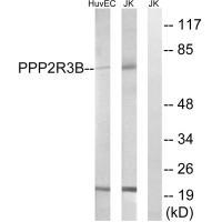 PPP2R5D Antibody