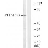 P2R3B Antibody