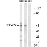 PP4R2 Antibody