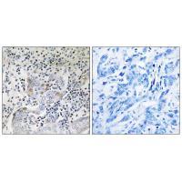 SESN1 Antibody