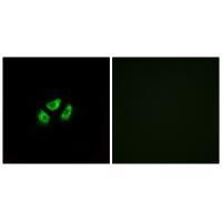 SCN7A Antibody