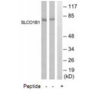 SLCO1B1 Antibody