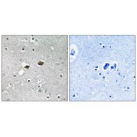 TIGD3 Antibody 