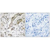 TCEAL3/5/6 Antibody