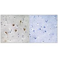 MTERF Antibody