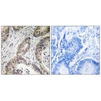 TUT1 Antibody