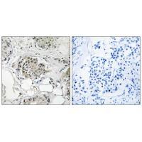USP13 Antibody