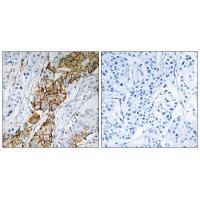 USP32 Antibody