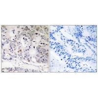 UBTD1 Antibody