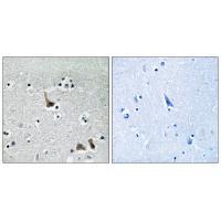 ATP6V1H Antibody
