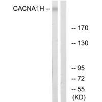 CACNA1H Antibody