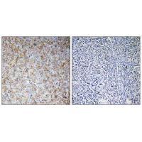 WASF2 Antibody