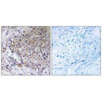 WASF3 Antibody