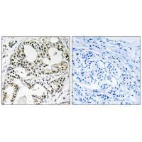 YEATS2 Antibody 