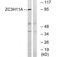 ZC11A Antibody