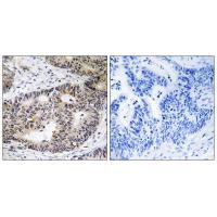 ZFYVE19 Antibody