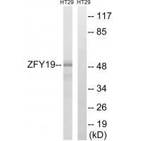 ZFYVE19 Antibody