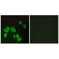 TTF2 Antibody