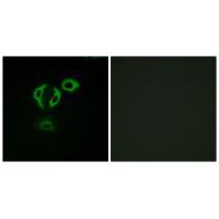 TACC3 Antibody
