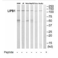 LIPB1 Antibody