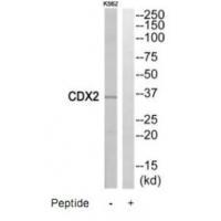 CDX2 Antibody 