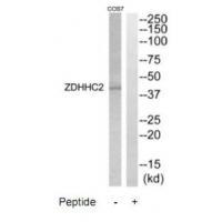 ZDHHC2 Antibody
