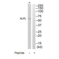 ALPL Antibody 