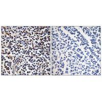 STK17B Antibody