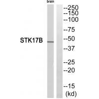 STK17B Antibody