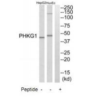 PHKG1 Antibody 