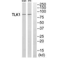 TLK1 Antibody