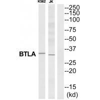 BTLA Antibody