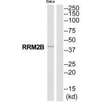 RRM2B Antibody