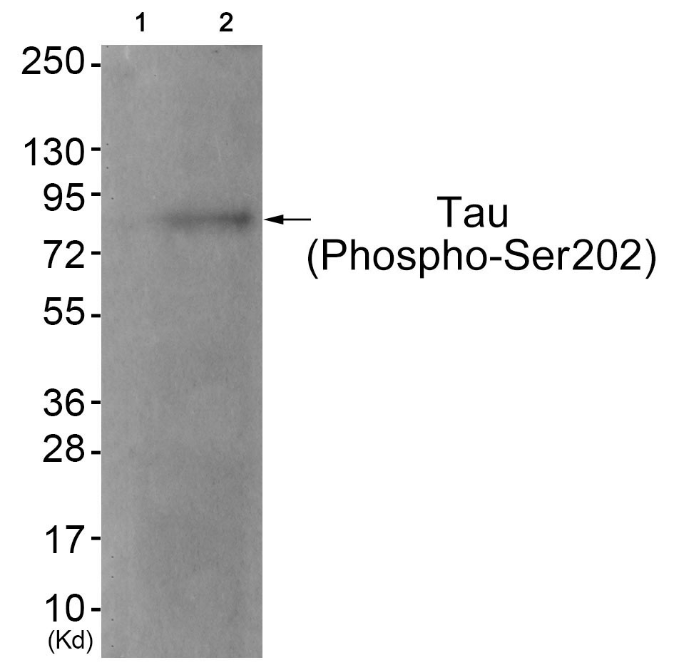Tau (Phospho-Ser202) Antibody