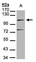 DNA ligase IV Antibody