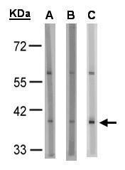 GPR91  Antibody