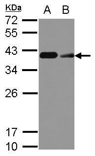 CD20 Antibody