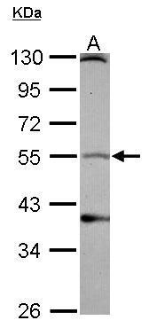 Dopamine Receptor D1 Antibody