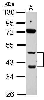 Retinoic Acid Receptor beta Antibody